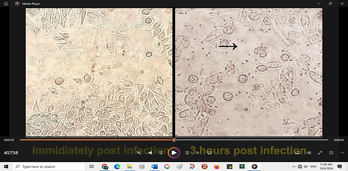 Phagocytosis of Leishmania Major Parasites by Murine Macrophages